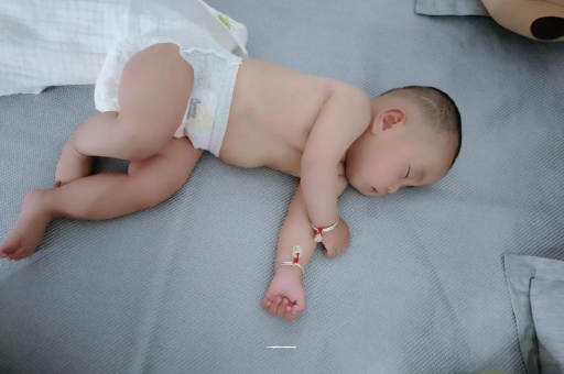 义乌六个月宝宝眼睛散光